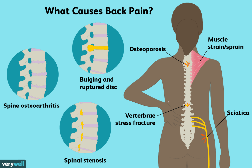 Back Pain, Holistic Treatments and Professional Advice